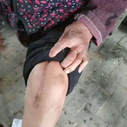 신신제약 아렉스 파스, 무릎, 허리에 붙이면 시원합니다.