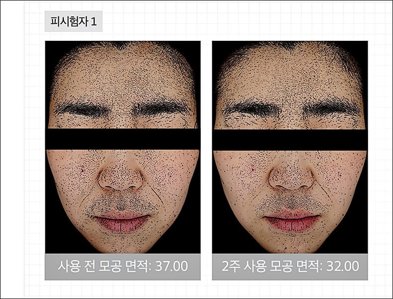 메디큐브 제로모공패드 2.0 효과 및 가격 (유재석 패드)