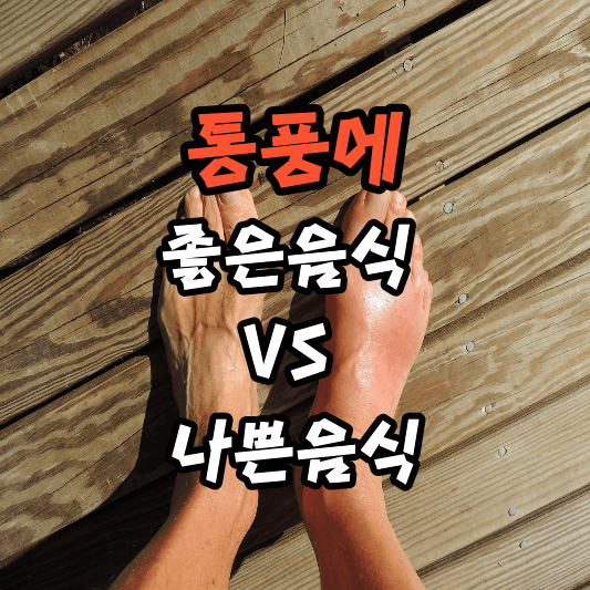 통풍에 좋은음식과 나쁜음식