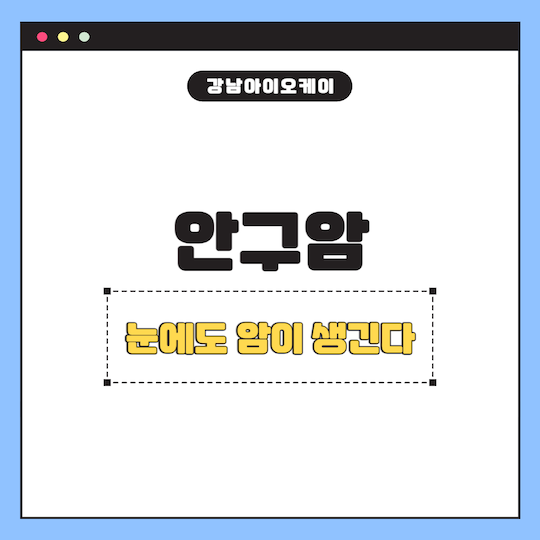 안구암-원인-예방법