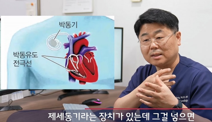 부정맥-정보영-교수