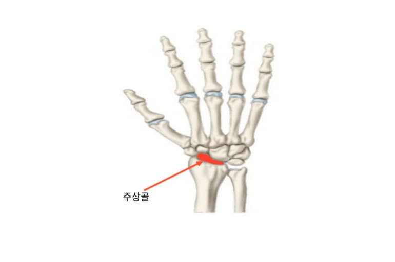 주상골 골절의 진단과 치료