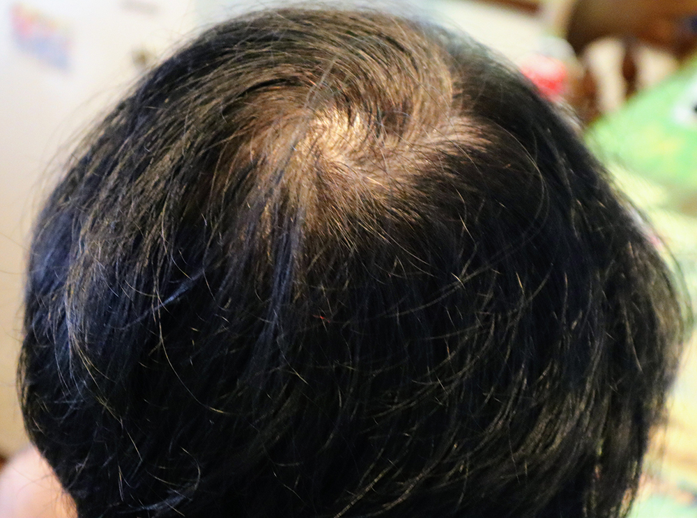 갱년기 증상 30가지