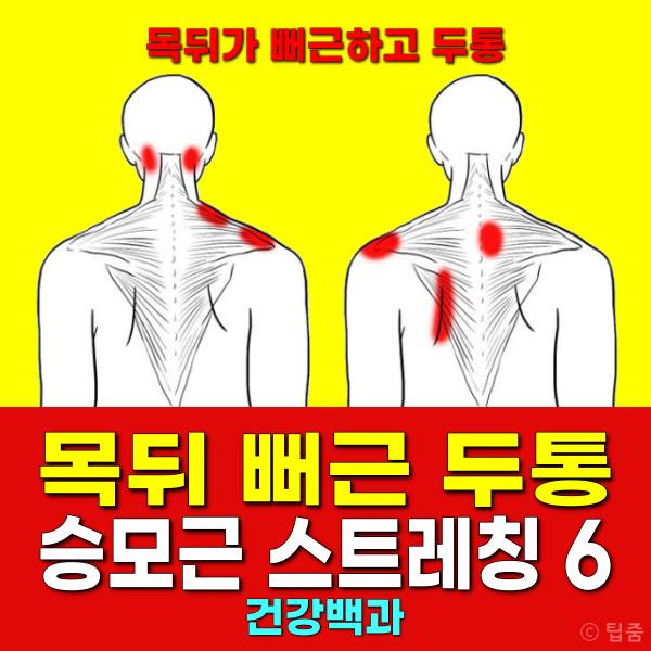 목뒤가 뻐근하고 두통 승모근 스트레칭