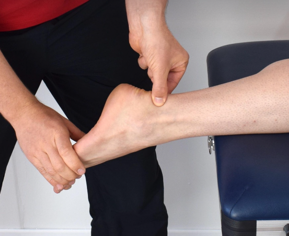 발목터널증후군의 모습