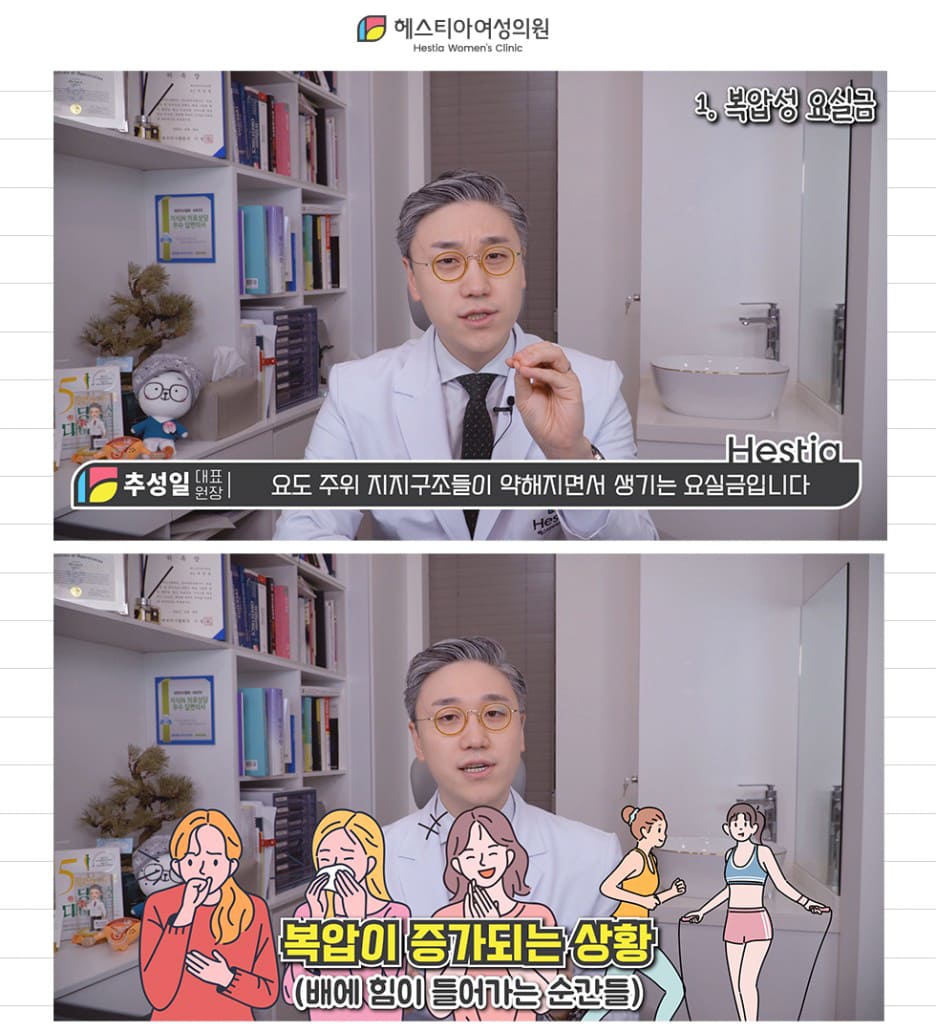 요실금약
요실금운동