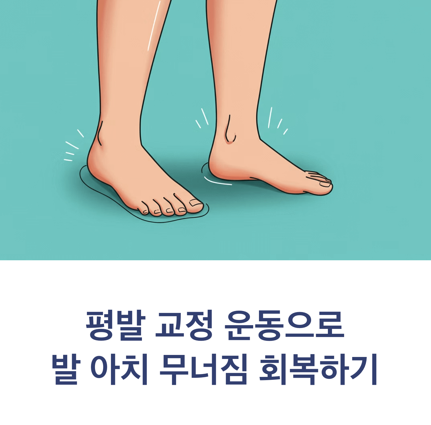 평발 교정 운동으로 발 아치 무너짐 회복하기