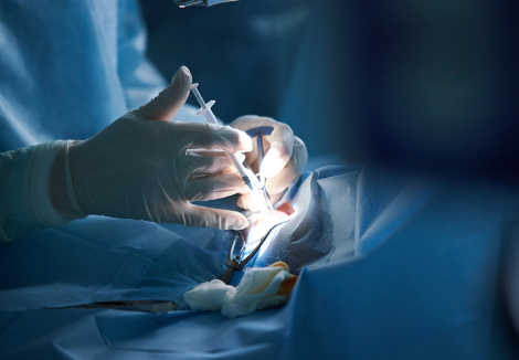 대상포진고주파열응고술