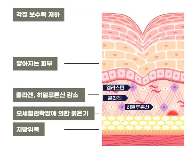 피부의-단면층-설명-그림