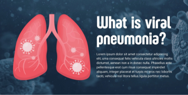 폐와 관련된 사진입니다