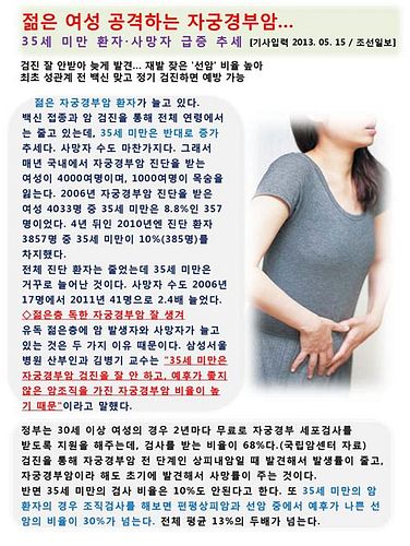 자궁경부조직검사