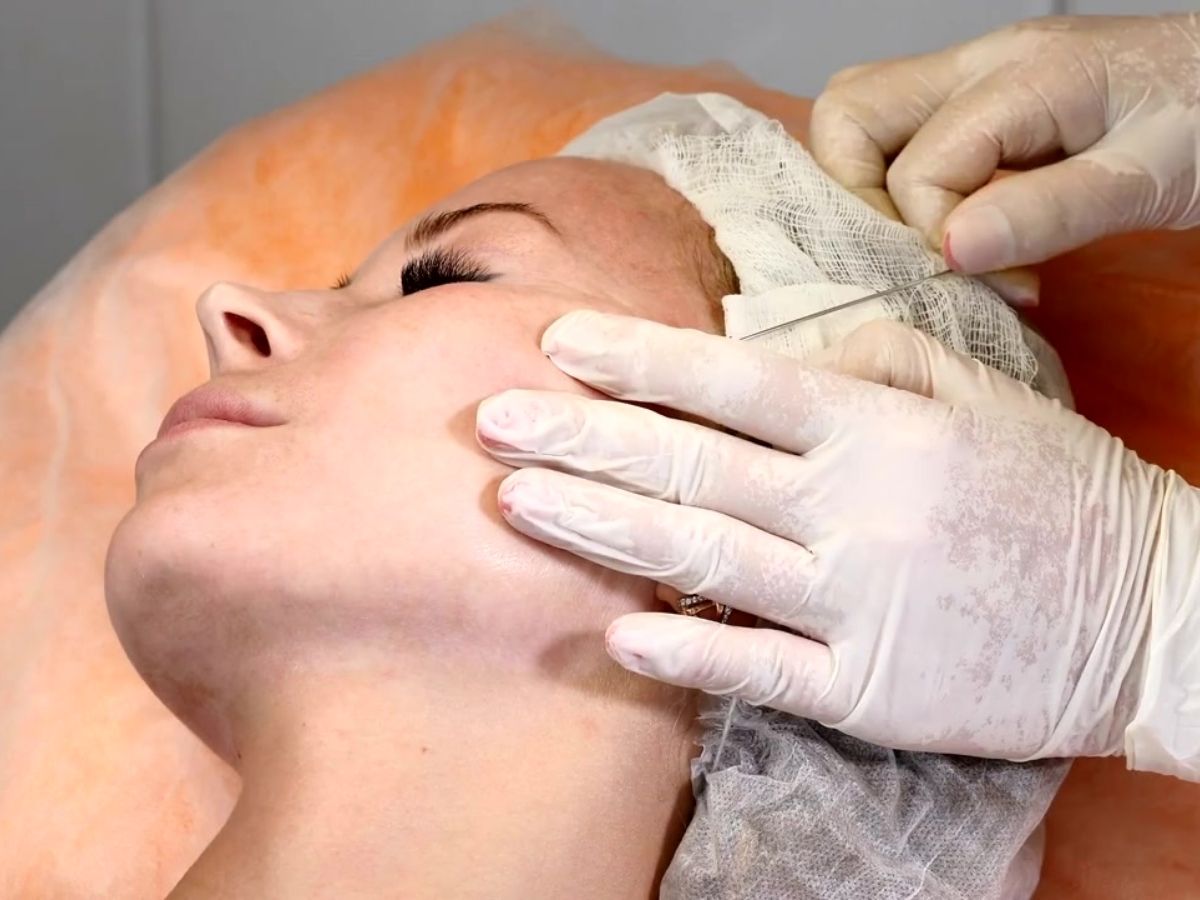 비절개 안면거상술이란?