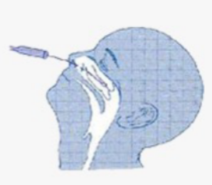 마이코플라즈마 폐렴 원인, 증상, 항생제 치료