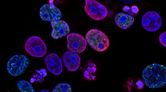 일상생활에서 실천할 수 있는 대장암 예방법 5가지