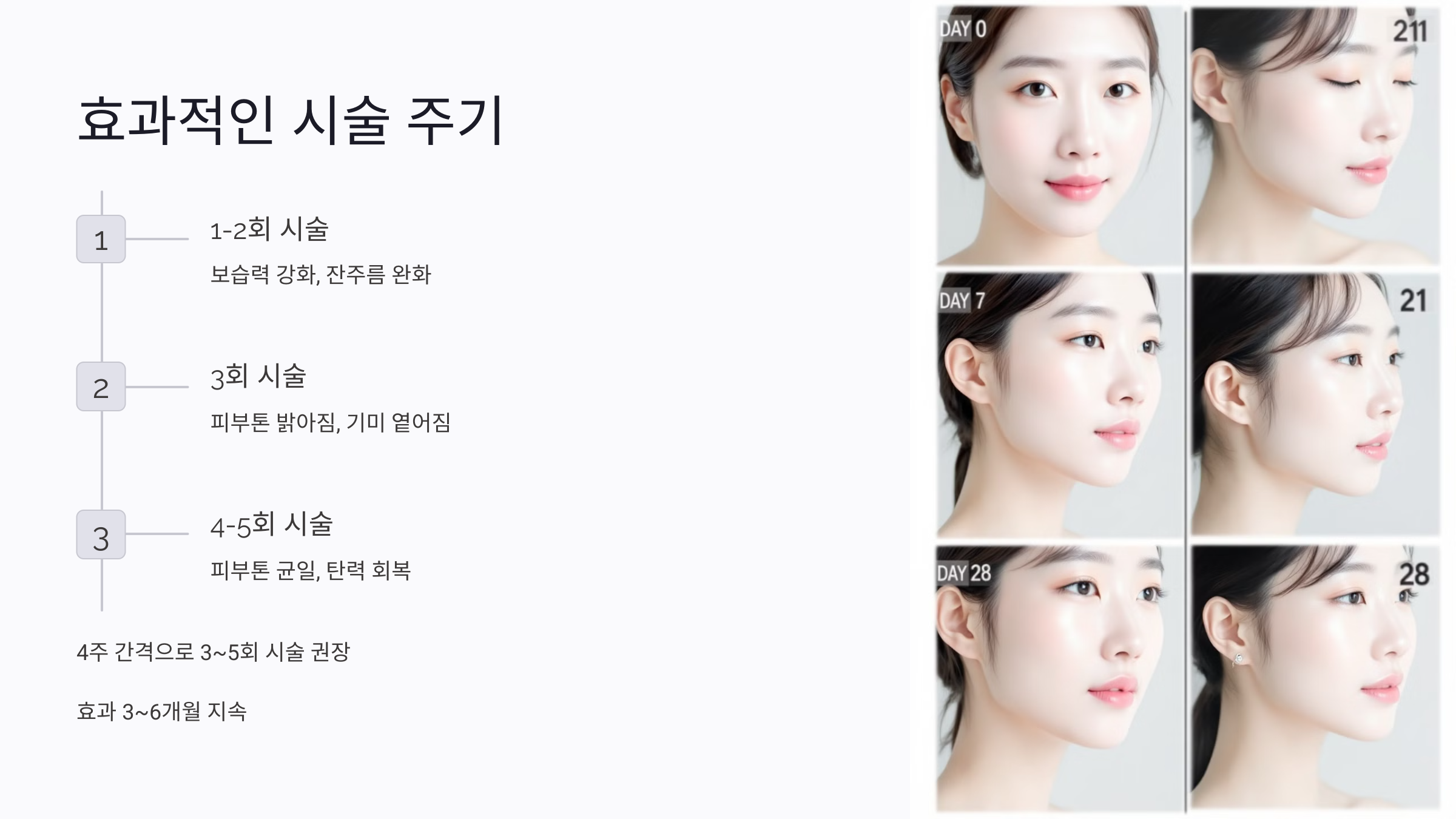 연어주사의 효과적인 시술 주기 및 지속 기간