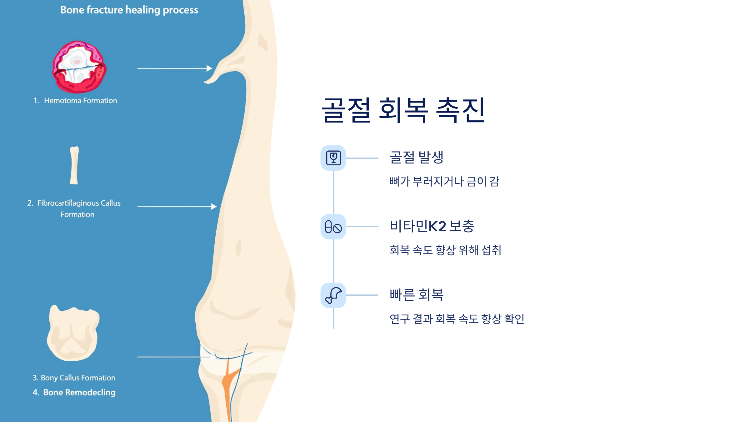 비타민K2 사진입니다.