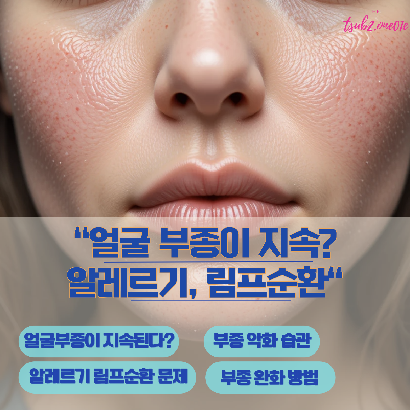 얼굴 부종이 지속된다면? 알레르기와 림프 순환 문제