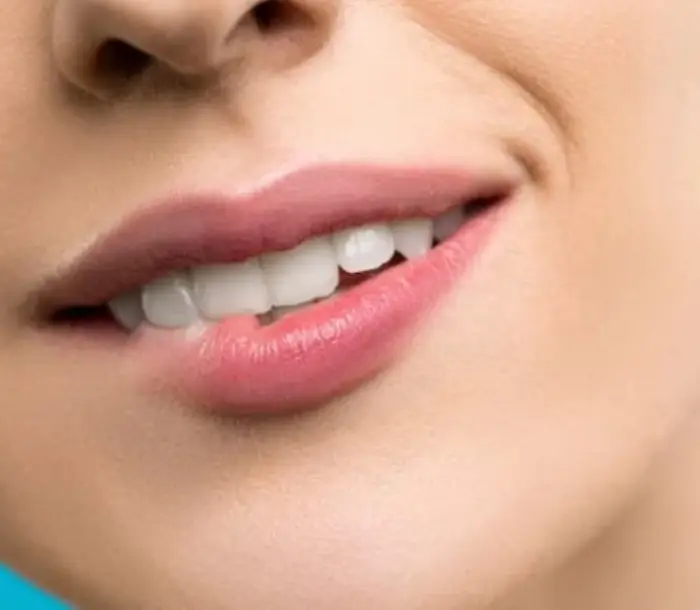 페리덱스 사용법