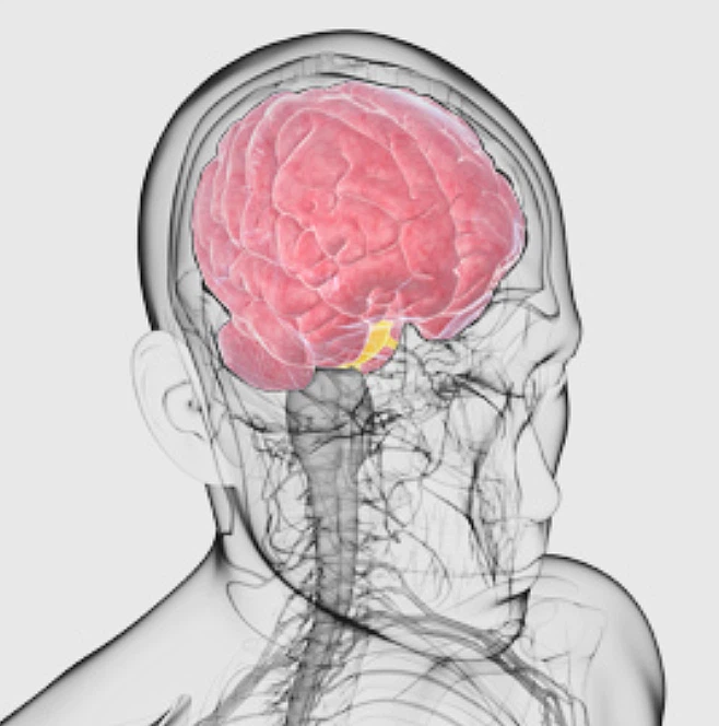 뇌졸중 전조증상