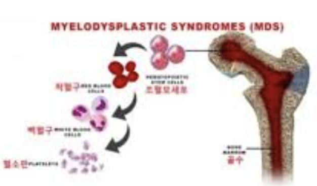 백혈구 수치가 낮은 이유 22