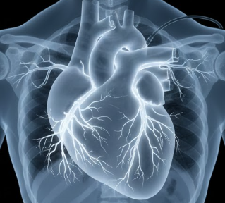 고지혈증 영양제