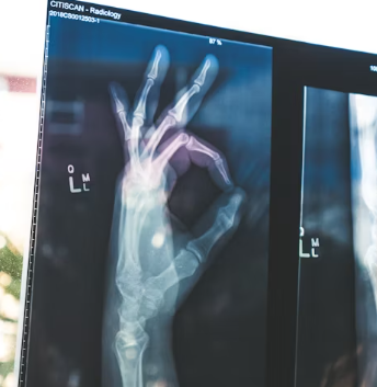 류마티스 관절염 초기증상 치료 원인 예방법