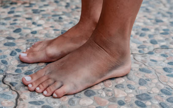 발등이 찌릿찌릿 증상