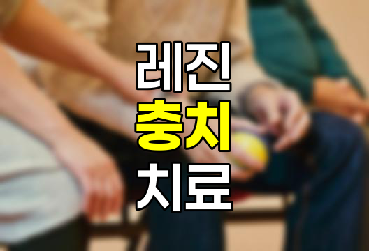 레진 충치 치료의 종류와 특성