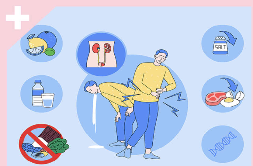 요로결석 증상 1