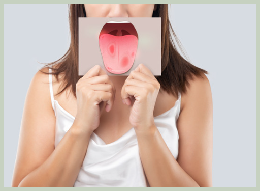 설암 치료 방법