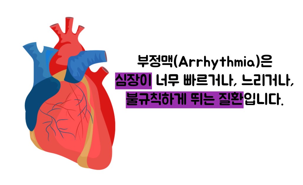 부정맥 증상