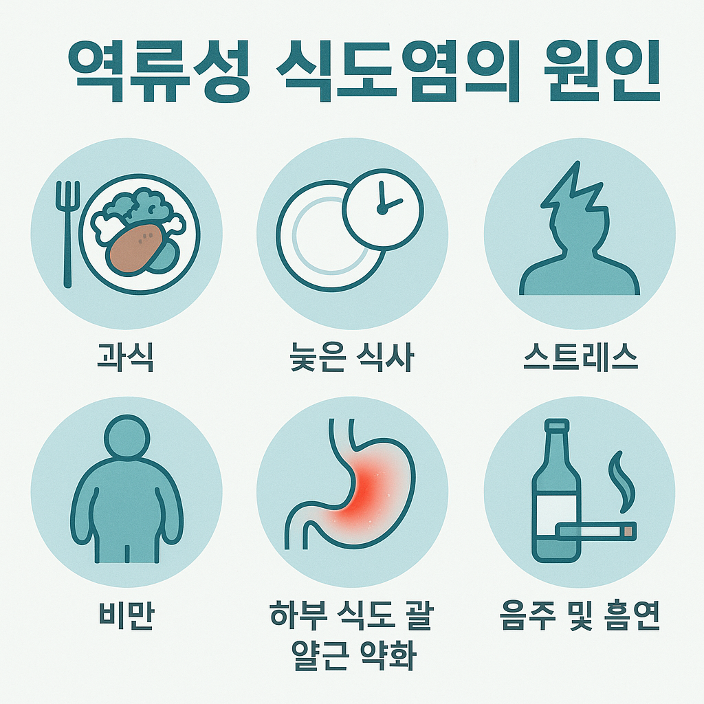 역류성 식도염 증상 치료기간, 얼마나 걸릴까?