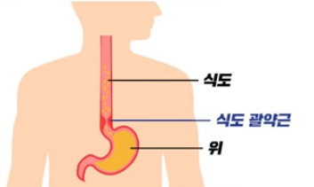 위장 설명 이미지