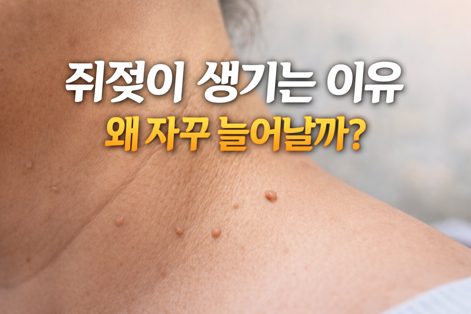 쥐젖이 생기는 이유