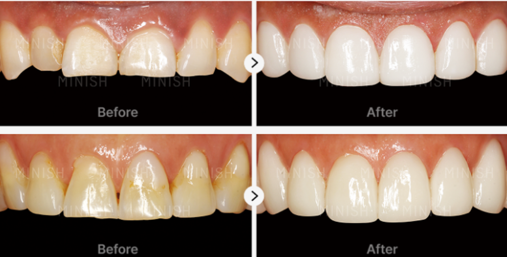 내게 맞는 선택은 무엇일까?
