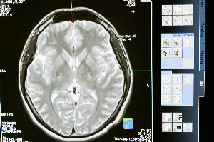 건강한 수면을 위한 영양 성분과 음식 추천 및 전문 지식