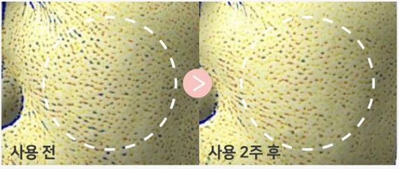 마데카-프라임-후기