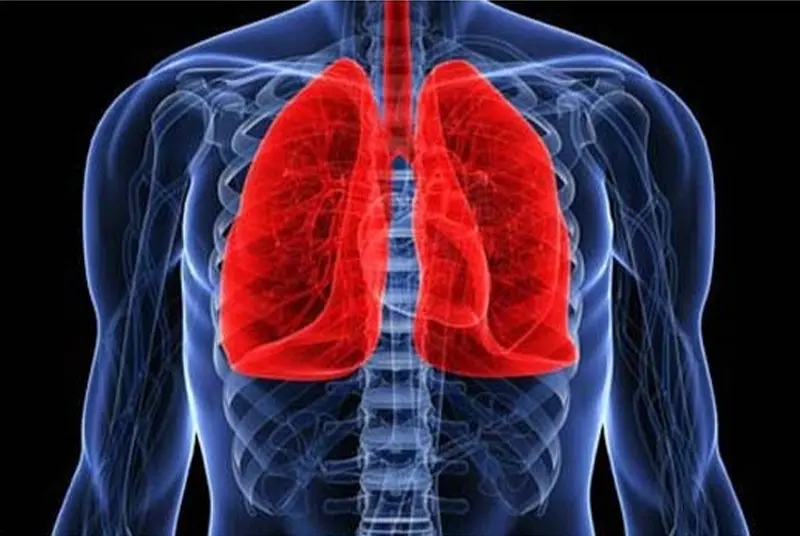 폐암 건강 관리 음식