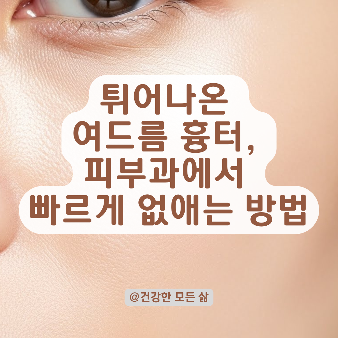 튀어나온 여드름 흉터, 피부과에서 빠르게 없애는 시술 총정리.