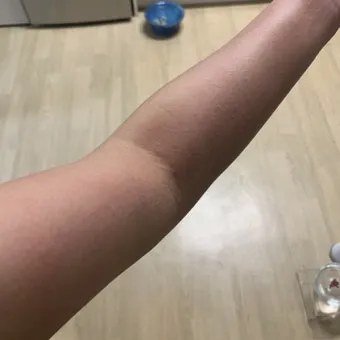 고양이 털 알레르기 완화 방법과 생활 관리 팁_17