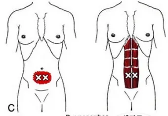 배보다 배꼽이 더 크다 뜻과 영어 속담 표현 안내집_11