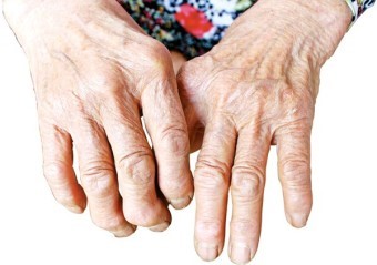 우리-할머니의-굽고-일부가-잘려나간-모진-세월을-담고있는-손