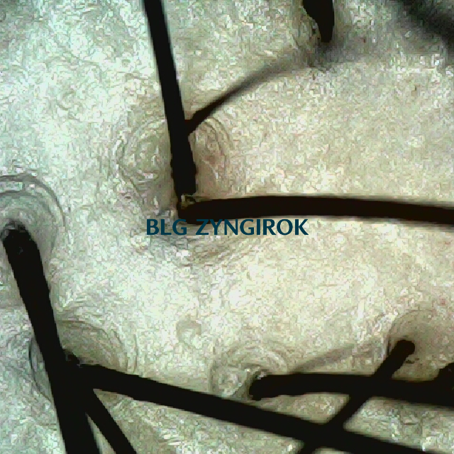 피나모아 복용 18주차 - 정수리 위치 두피 모습이다.