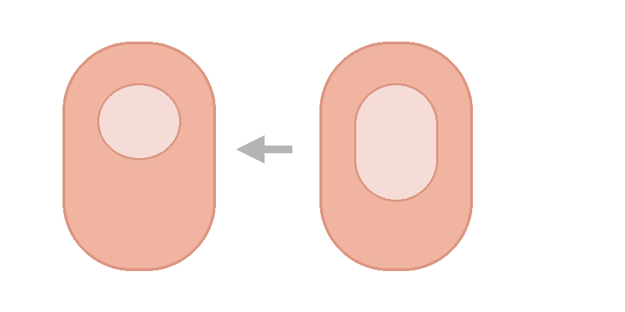 손톱 치료는 왜 오래 걸릴까? 좋아 보이기까지 걸리는 현실적인 시간표손톱은 ‘치료 즉시 회복’되는 조직이 아니다