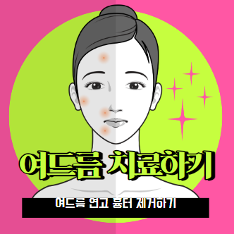 여드름 빨리 없애는법 여드름 연고 흉터 제거
