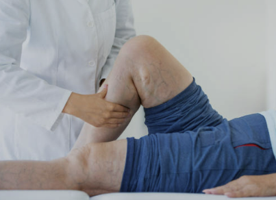 하지정맥류 증상 좋은운동 치료방법 총정리(최신)