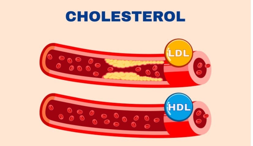 HDL 콜레스테롤 높이는 폴리코사놀 관련 사진