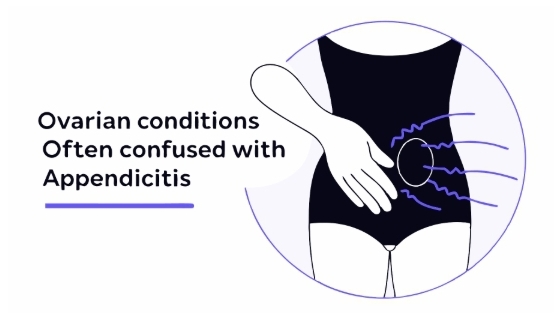 맹장염 증상과 비슷한 다른 질환