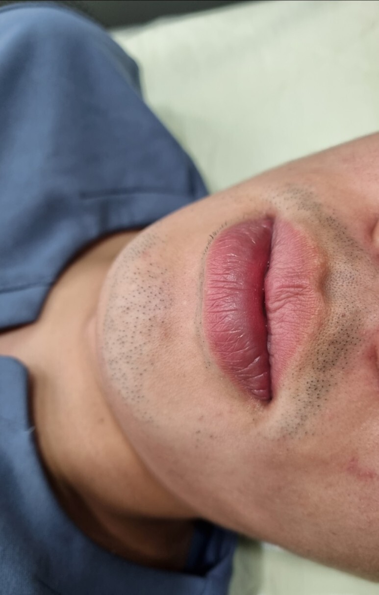 아포지 엘리트 플러스 후기