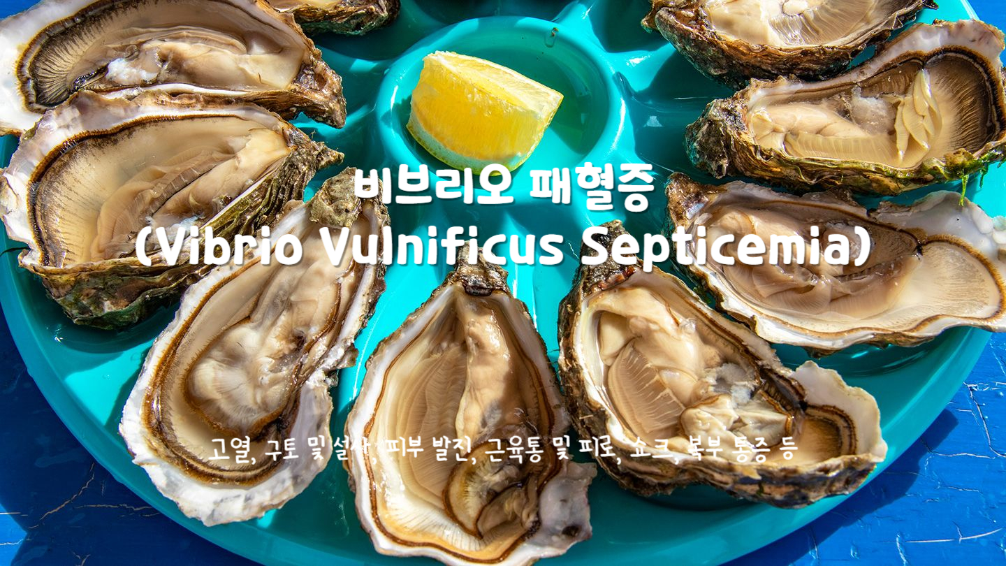비브리오 패혈증(Vibrio Vulnificus Septicemia)
비브리오 패혈증의 주요 증상 : 고열, 구토 및 설사, 피부 발진, 근육통 및 피로, 쇼크, 복부 통증 등
